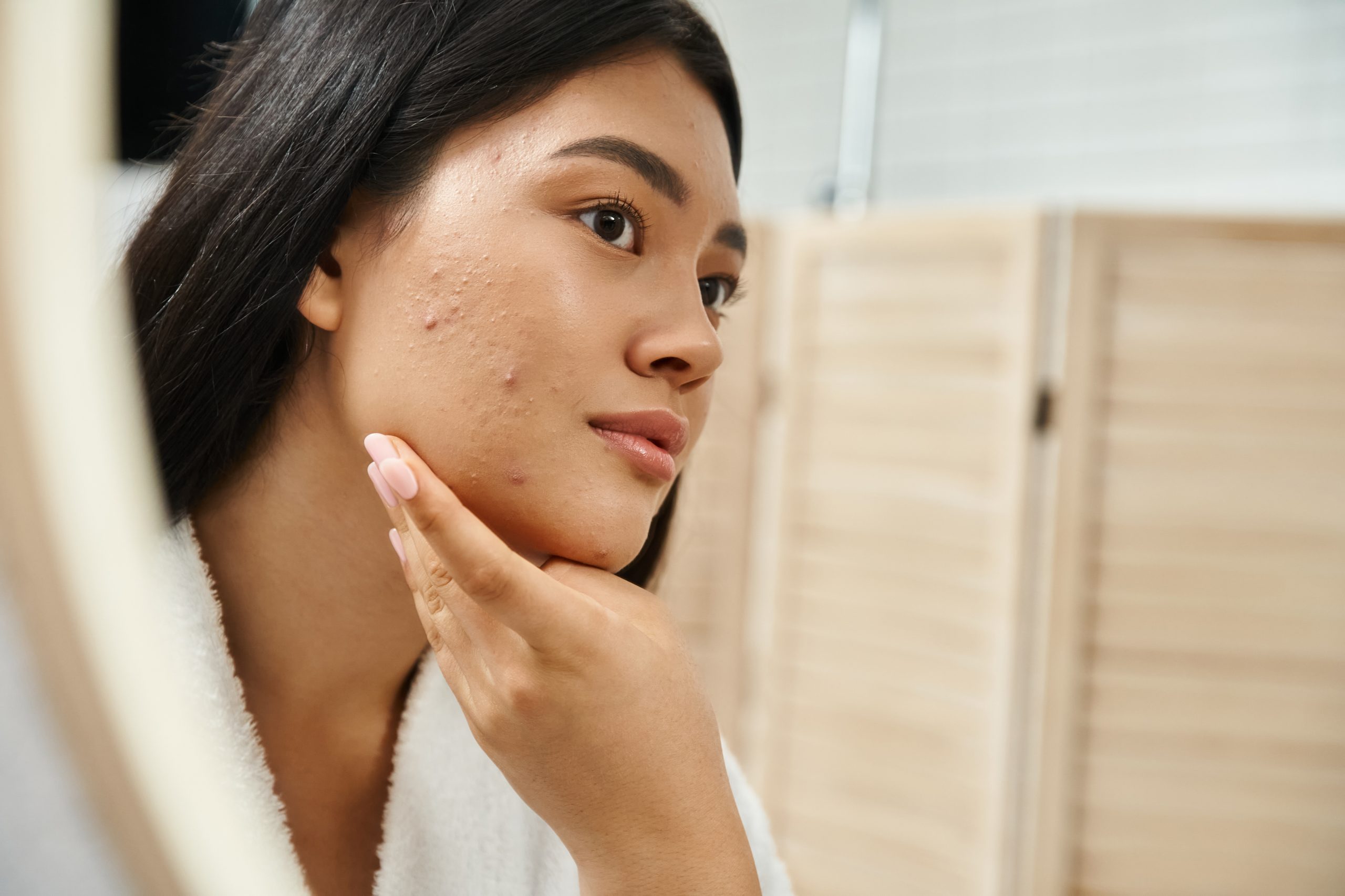 10 Effective Acne Treatments: A Dermatologist’s Guide